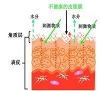 vinistyle教你掌控敏感肌，不做嬌氣“瓷娃娃”